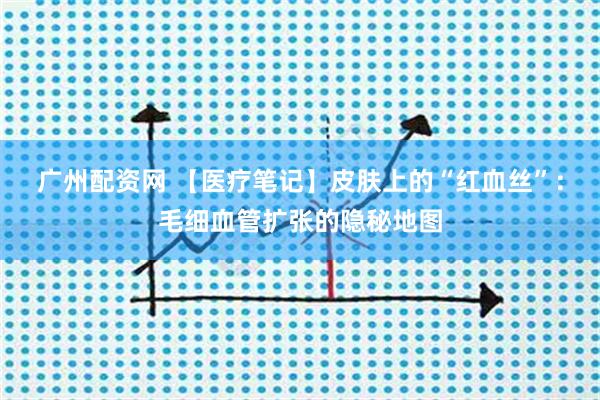 广州配资网 【医疗笔记】皮肤上的“红血丝”：毛细血管扩张的隐秘地图